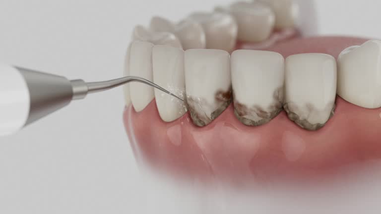 Reliable Root Canal Treatment contractor in Cabarrus County County, NC by Dentist Open Now